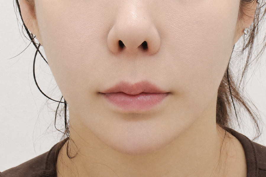After