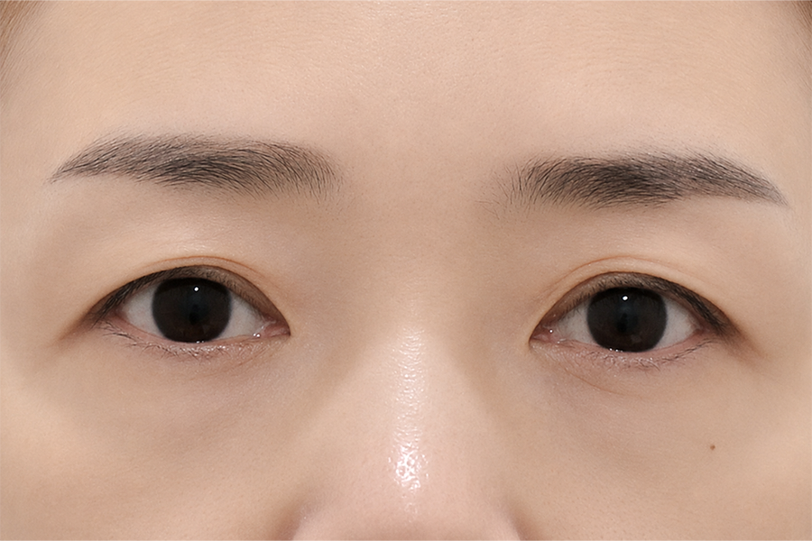 Before