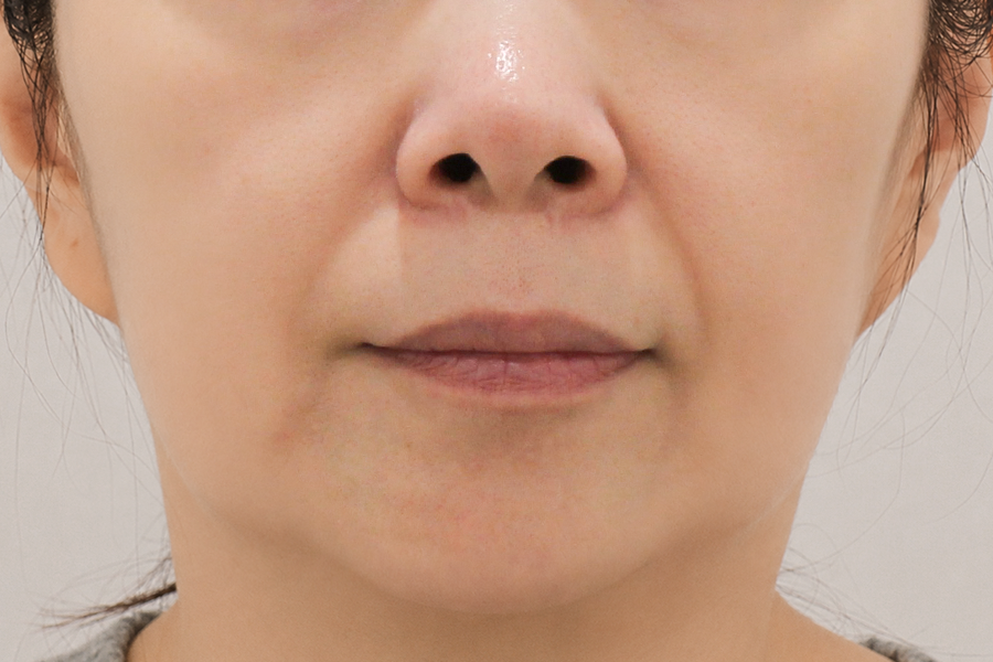 Before